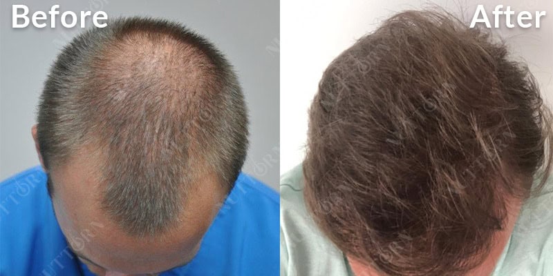 Before & After Image 10