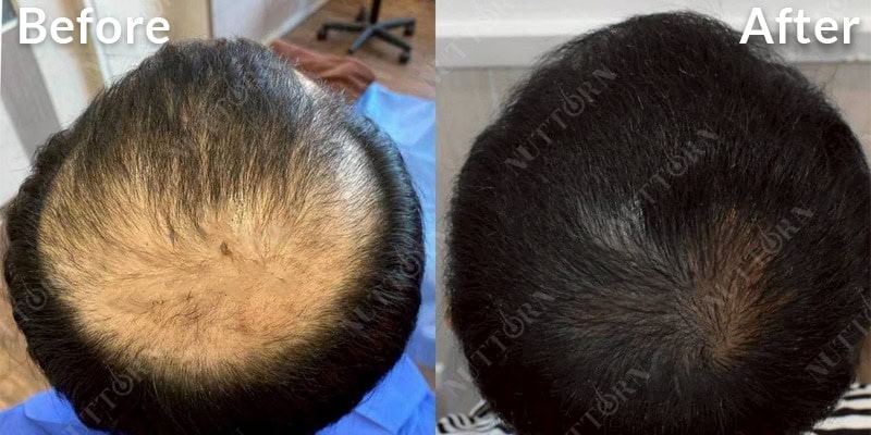 Before & After Image 11