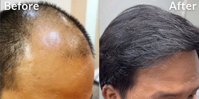 Before & After Image 12