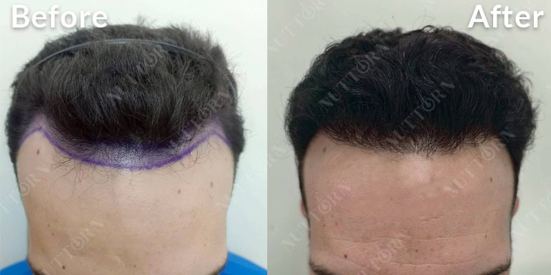 Before & After Image 13