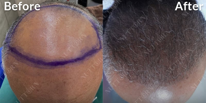 Before & After Image 14