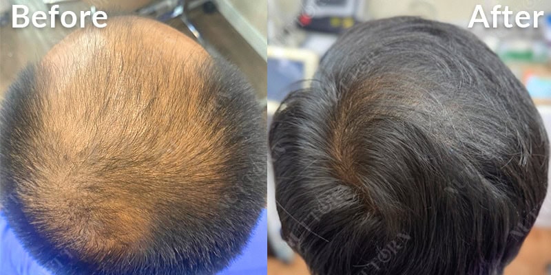 Before & After Image 15