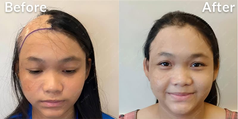 Before & After Image 16