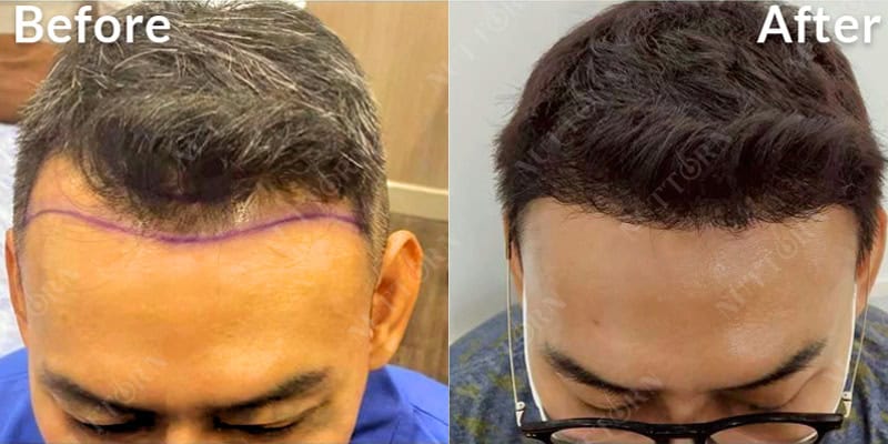 Before & After Image 17