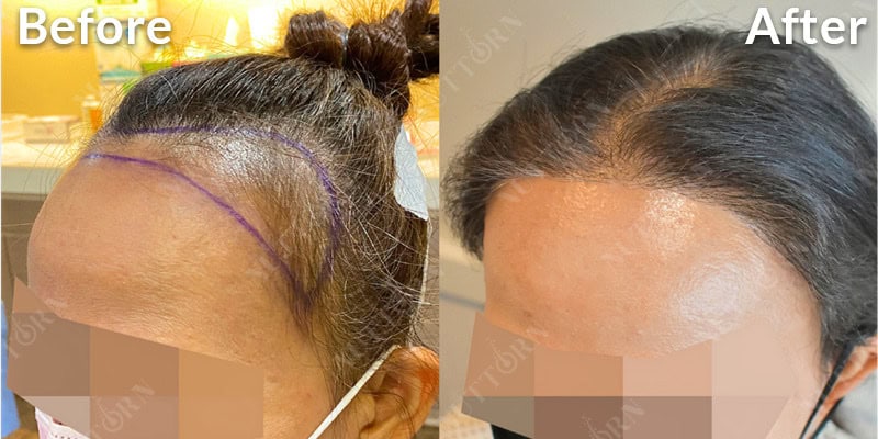 Before & After Image 18