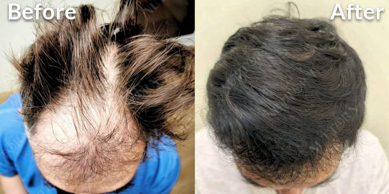 Before & After Image 19