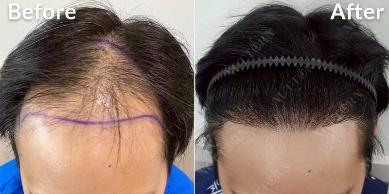 Before & After Image 2