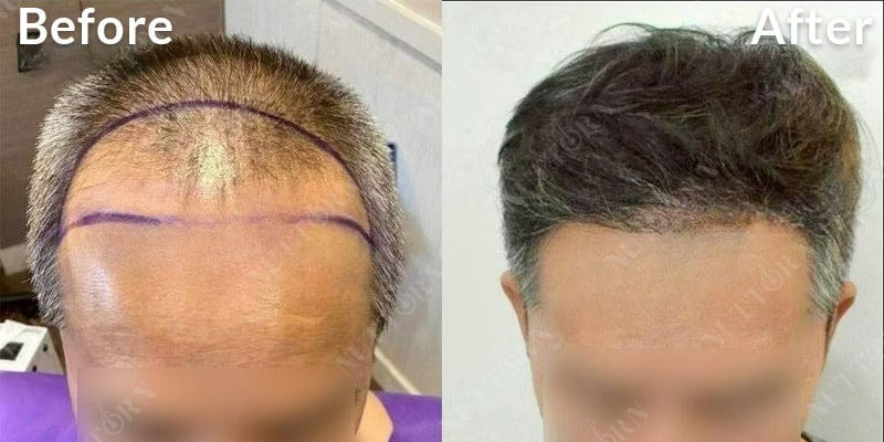 Before & After Image 20