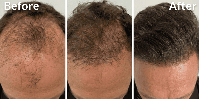 Before & After Image 3