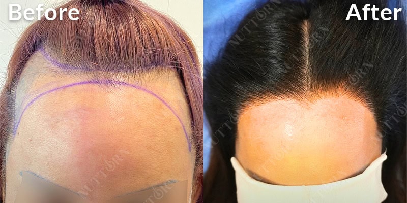 Before & After Image 5