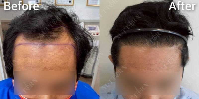 Before & After Image 6