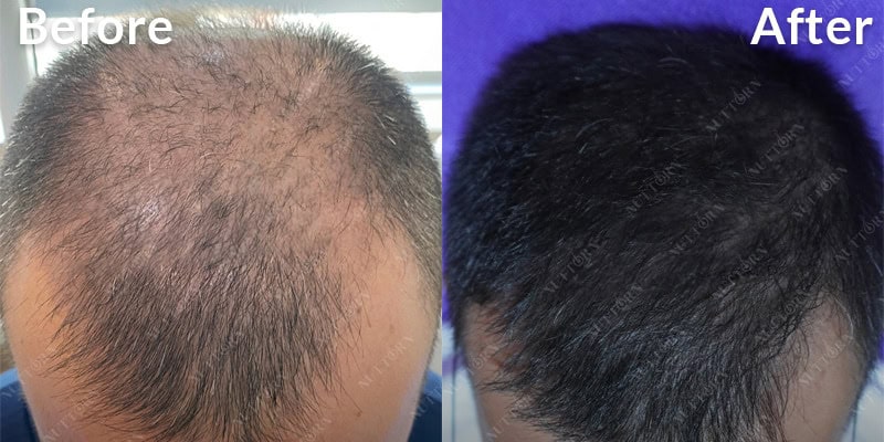 Before & After Image 7