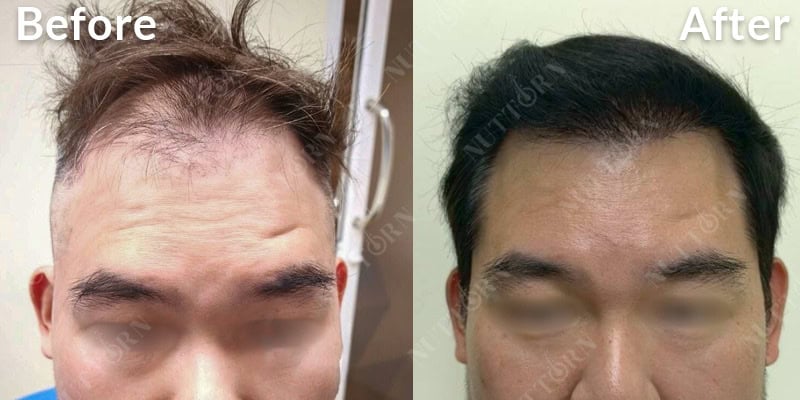 Before & After Image 8