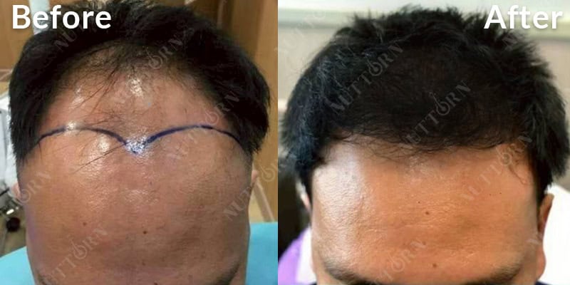 Before & After Image 9